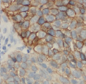 ARHGEF10 Antibody