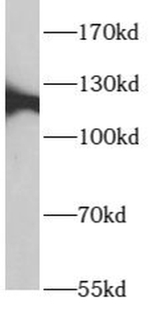 ARHGEF18 Antibody