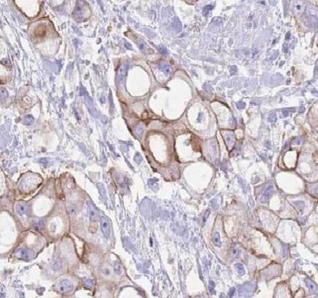 ARHGEF18 Antibody