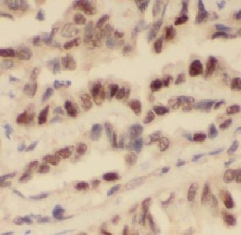 ARHGEF5 Antibody