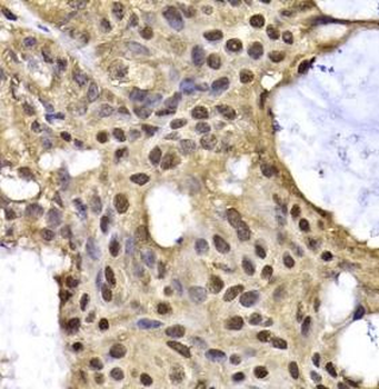 ARID3A Antibody