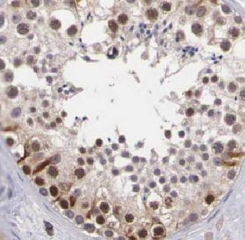 ARID4B Antibody