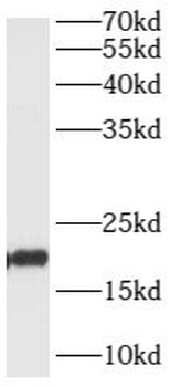 ARL1 Rabbit Polyclonal Antibody