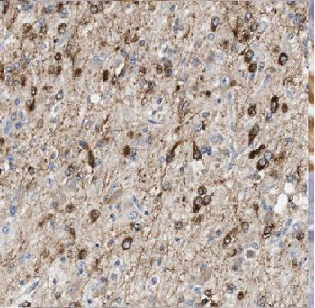 ARL2BP Antibody