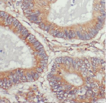 ARL4C Antibody
