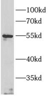 ARMC5 Rabbit Polyclonal Antibody