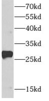 ARMC7 Rabbit Polyclonal Antibody