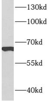ARMCX2 Rabbit Polyclonal Antibody