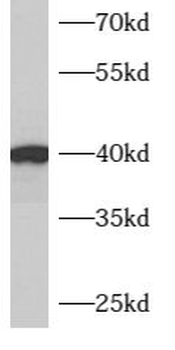 ARMCX3 Rabbit Polyclonal Antibody