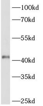 ACTR2 Rabbit Polyclonal Antibody