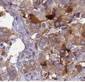 ACTR2 Rabbit Polyclonal Antibody
