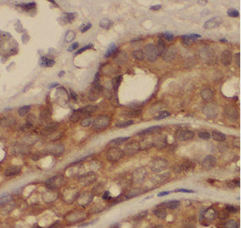 ARPC1B Antibody
