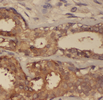 ARPC2 Antibody