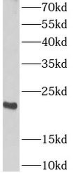 ARPC4 Antibody