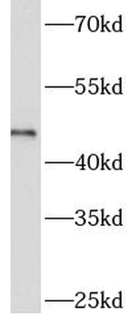 ART3 Rabbit Polyclonal Antibody
