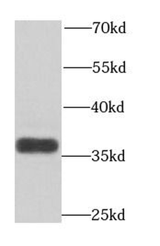 ART5 Antibody