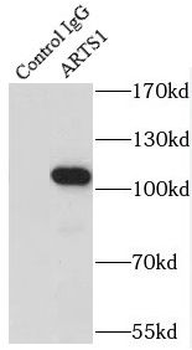 ERAP1 Antibody