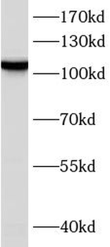ERAP1 Antibody