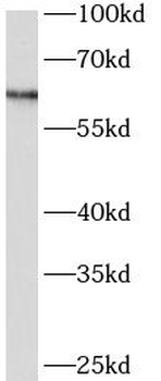 ARSD Rabbit Polyclonal Antibody