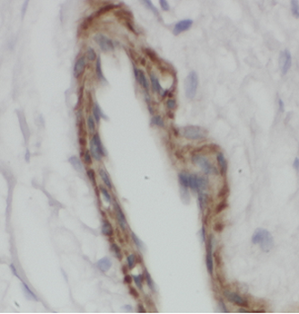 ARSD Antibody