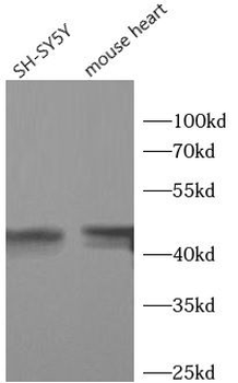 ASAH1 Antibody