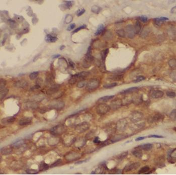 ASAH1 Antibody