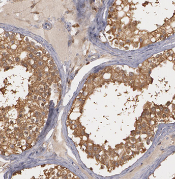 ASB17 Antibody