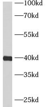ASB5 Antibody