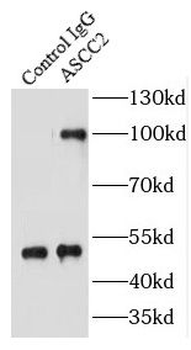ASCC2 Antibody