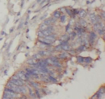 ASCC2 Antibody