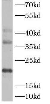 ASF1A Antibody