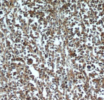 ASF1A Antibody