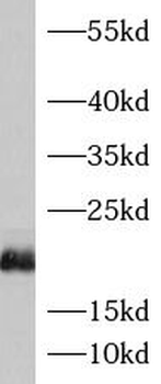 ASF1B Rabbit Polyclonal Antibody