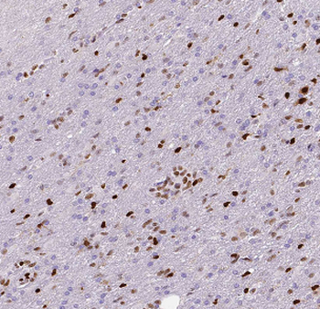 ASH2L Antibody