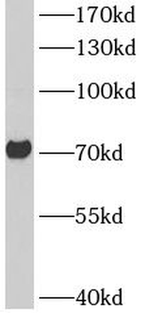 ASIC2 Antibody