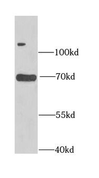 ASMTL Antibody