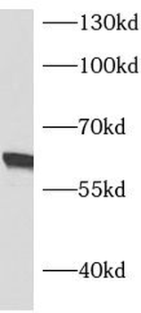 ASNS Antibody