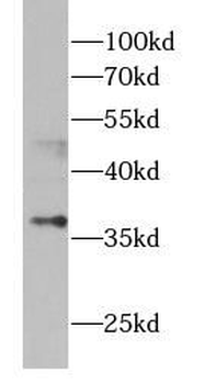 ASPA Antibody