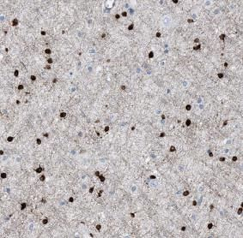 ASPA Antibody