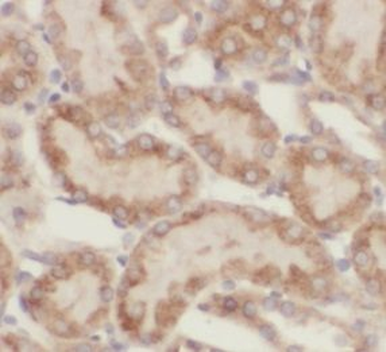 ASPH Rabbit Polyclonal Antibody