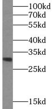 ASRGL1 Antibody