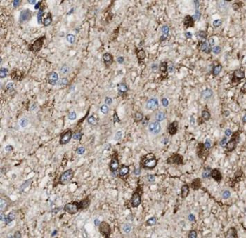 ASRGL1 Antibody