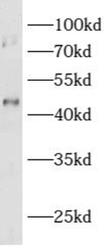 ASTL Rabbit Polyclonal Antibody