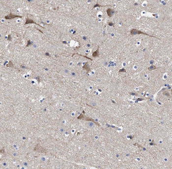 ASTN2 Antibody