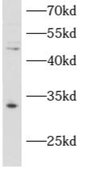 ATAD1 Antibody