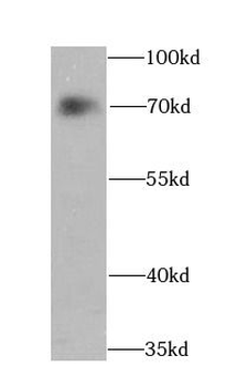 ATF2 Rabbit Polyclonal Antibody