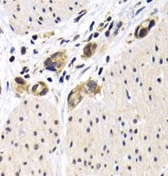 ATF2 Rabbit Polyclonal Antibody