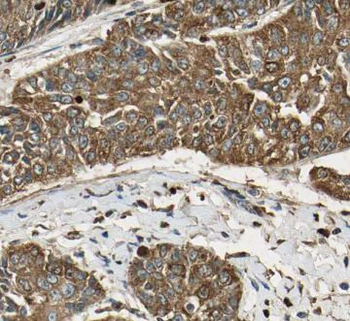 ATF6 Antibody