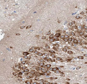 ATF6B Antibody