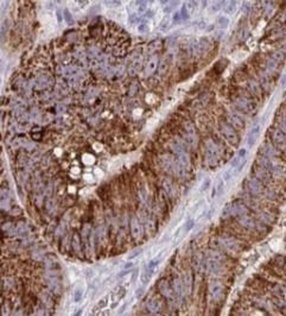 ATG16L1 Antibody